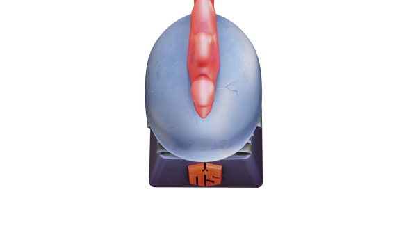 Whack-a-Chicken (CT)